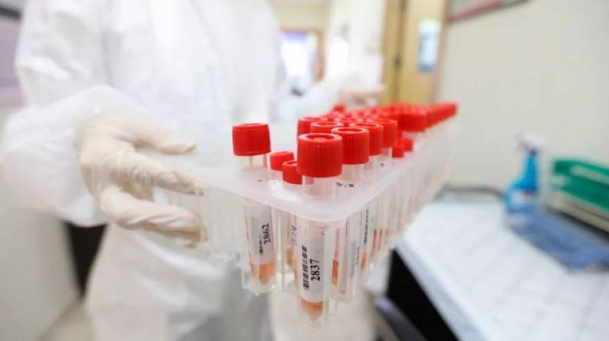 الصحة: تسجيل 353 إصابة جديدة بفيروس كورونا و199 حالة تعافٍ
