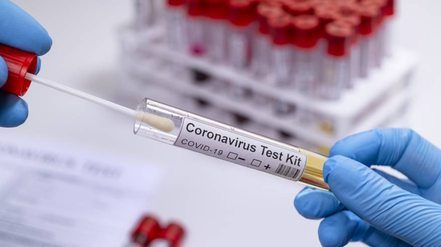 الصحة: تسجيل حالة وفاة و382 إصابة جديدة بفيروس كورونا و627 حالة تعافٍ